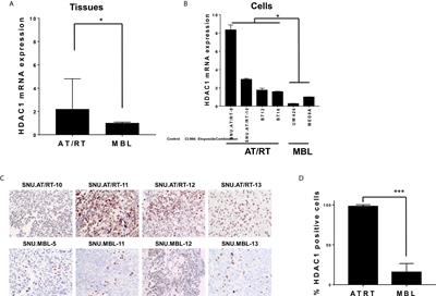 Combination Treatment of CI-994 With Etoposide Potentiates Anticancer Effects Through a Topoisomerase II-Dependent Mechanism in Atypical Teratoid/Rhabdoid Tumor (AT/RT)